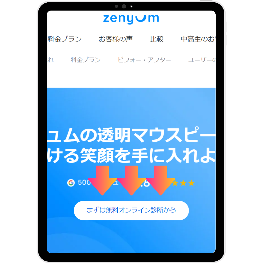 ゼニュム矯正　無料診断